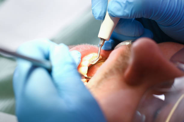Best Emergency Treatment for Toothache in Star, NC