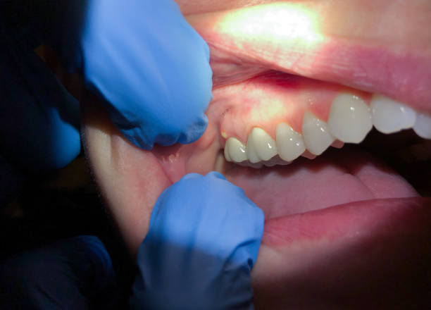 Best Emergency Treatment for Toothache in Star, NC